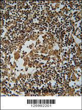 Anti-IL36A Rabbit Polyclonal Antibody (FITC (Fluorescein Isothiocyanate))