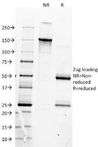 SDS-PAGE analysis of Anti-MyoD1 Antibody [5.8A] under non-reduced and reduced conditions; showing intact IgG and intact heavy and light chains, respectively. SDS-PAGE analysis confirms the integrity and purity of the Antibody