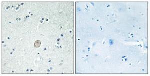 Immunohistochemical analysis of paraffin-embedded human brain tissue using Anti-C3AR1 Antibody. The right hand panel represents a negative control, where the antibody was pre-incubated with the immunising peptide