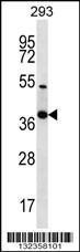 Anti-NKX2-2 Rabbit Polyclonal Antibody (HRP (Horseradish Peroxidase))