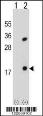 Anti-PLA2G1B Rabbit Polyclonal Antibody (FITC (Fluorescein Isothiocyanate))