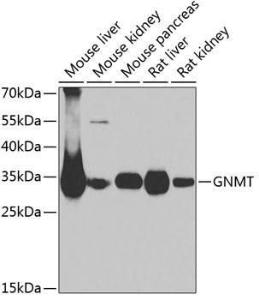 Western blot analysis of extracts of various cell lines, using Anti-GNMT Antibody (A9938) at 1:1,000 dilution. The secondary antibody was Goat Anti-Rabbit IgG H&L Antibody (HRP) at 1:10,000 dilution.