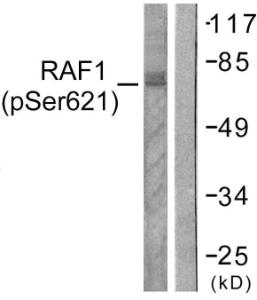 Western blot analysis of lysates from HeLa cells treated with UV 5' using Anti-C-RAF (phospho Ser621) Antibody. The right hand lane represents a negative control, where the Antibody is blocked by the immunising peptide