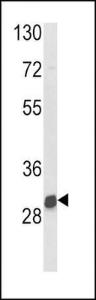 Anti-NAT2 Rabbit Polyclonal Antibody (HRP (Horseradish Peroxidase))