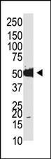 Anti-TRDMT1 Rabbit Polyclonal Antibody (APC (Allophycocyanin))