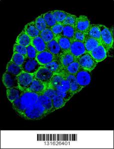 Anti-C1QC Rabbit Polyclonal Antibody (HRP (Horseradish Peroxidase))