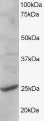 Anti-CYB561D2 Antibody (A83880) staining (1 µg/ml) of human liver lysate (RIPA buffer, 35 µg total protein per lane). Primary incubated for 1 hour. Detected by western blot using chemiluminescence