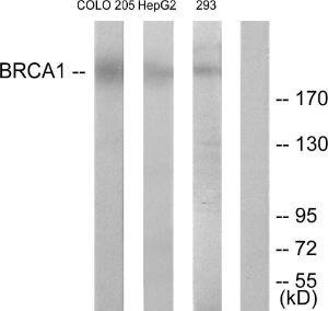 Western blot analysis of lysates from COLO205 and HepG2 cells, treated with serum 20% 15' using Anti-BRCA1 Antibody. The right hand lane represents a negative control, where the antibody is blocked by the immunising peptide