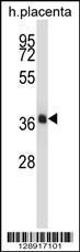 Anti-NKX2-4 Rabbit Polyclonal Antibody (AP (Alkaline Phosphatase))