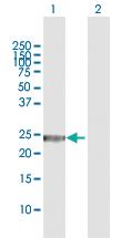 Anti-GSTZ1 Rabbit Polyclonal Antibody