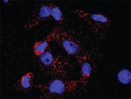 Anti-CDKN1A Antibody Pair