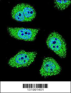 Anti-PAK6 Rabbit Polyclonal Antibody (FITC (Fluorescein Isothiocyanate))