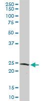 Anti-GSTZ1 Rabbit Polyclonal Antibody