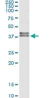 Anti-FAS Antibody Pair