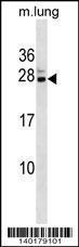 Anti-CBX5 Rabbit Polyclonal Antibody (HRP (Horseradish Peroxidase))