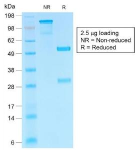 Anti-HCG beta antibody