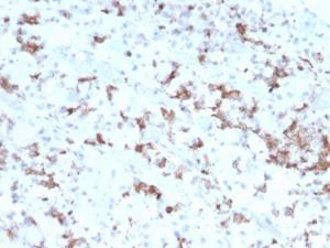 Immunohistochemical analysis of formalin-fixed, paraffin-embedded human pituitary using Anti-Prolactin Antibody [PRL/2641]