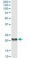 Anti-PRKD1 Mouse Monoclonal Antibody [clone: 2G2-1F1]