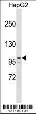 Anti-ARID5B Rabbit Polyclonal Antibody