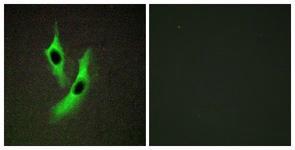 Anti-STEAP4 Rabbit Polyclonal Antibody