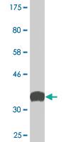 Anti-SYNJ1 Mouse Monoclonal Antibody [clone: 1A2]