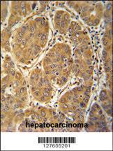 Anti-MCEE Rabbit Polyclonal Antibody (FITC (Fluorescein Isothiocyanate))