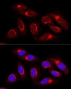 Anti-GRASP65 antibody