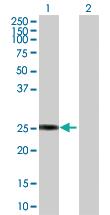 Anti-GSTZ1 Rabbit Polyclonal Antibody