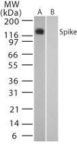 Anti-Sars Spike Protein Rabbit Polyclonal Antibody