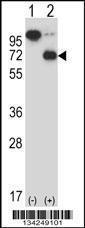 Anti-ARIH2 Rabbit Polyclonal Antibody (APC (Allophycocyanin))