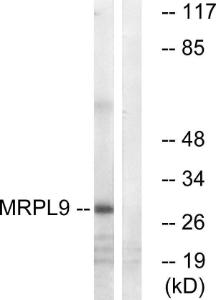 Anti-MRPL9 antibody