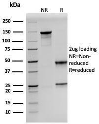 SDS-PAGE analysis of Anti-Prolactin Antibody [PRL/2641] under non-reduced and reduced conditions; showing intact IgG and intact heavy and light chains, respectively. SDS-PAGE analysis confirms the integrity and purity of the antibody