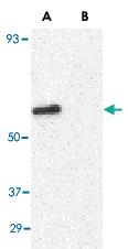 Anti-PTGDR2 Rabbit Polyclonal Antibody