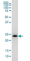 Anti-PCTP Mouse Monoclonal Antibody [clone: 1F9]