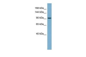 Anti-RAI14 Rabbit Polyclonal Antibody