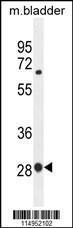 Anti-BTF3 Rabbit Polyclonal Antibody (HRP (Horseradish Peroxidase))