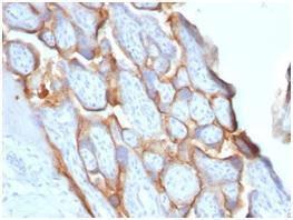 Immunohistochemical analysis of formalin-fixed, paraffin-embedded human placenta using Anti-HCG beta Antibody [HCGb/1996R]