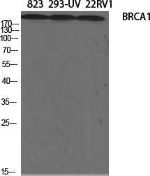 Western blot analysis of various cells using Anti-BRCA1 Antibody