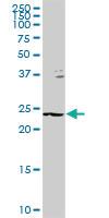 Anti-GSTZ1 Rabbit Polyclonal Antibody