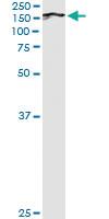 Anti-BUB1 Antibody Pair