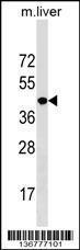 Anti-NKX2-5 Rabbit Polyclonal Antibody (AP (Alkaline Phosphatase))