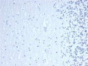 Negative Tissue Control: Immunohistochemical analysis of formalin-fixed, paraffin-embedded human brain using Anti-GATA3 Antibody [GATA3/6664] at 2 µg/ml in PBS for 30 minutes at room temperature