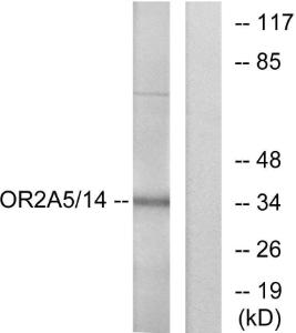 Western blot analysis of lysates from K562 cells using Anti-OR2A5 + OR2A14 Antibody. The right hand lane represents a negative control, where the antibody is blocked by the immunising peptide