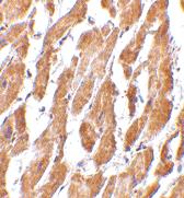 Anti-PTGDR2 Rabbit Polyclonal Antibody