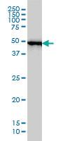 Anti-STK26 Mouse Monoclonal Antibody [clone: 2G6]