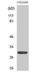 Anti-MRPL9 antibody