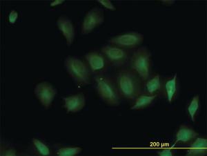 Anti-STK26 Mouse Monoclonal Antibody [clone: 2G6]