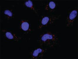 Anti-FGFR1 Antibody Pair