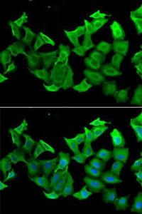 Immunofluorescence analysis of A549 cells using Anti-HAGH Antibody (A9940). DAPI was used to stain the cell nuclei (blue)