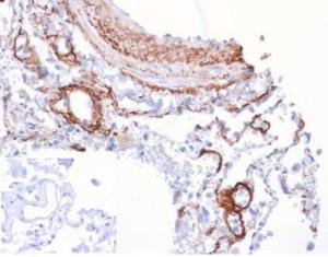 Immunohistochemical analysis of formalin-fixed, paraffin-embedded human lung tissue using Anti-FGF21 Antibody [FGF21/4343]. Inset: PBS instead of the primary antibody. Secondary antibody negative control.